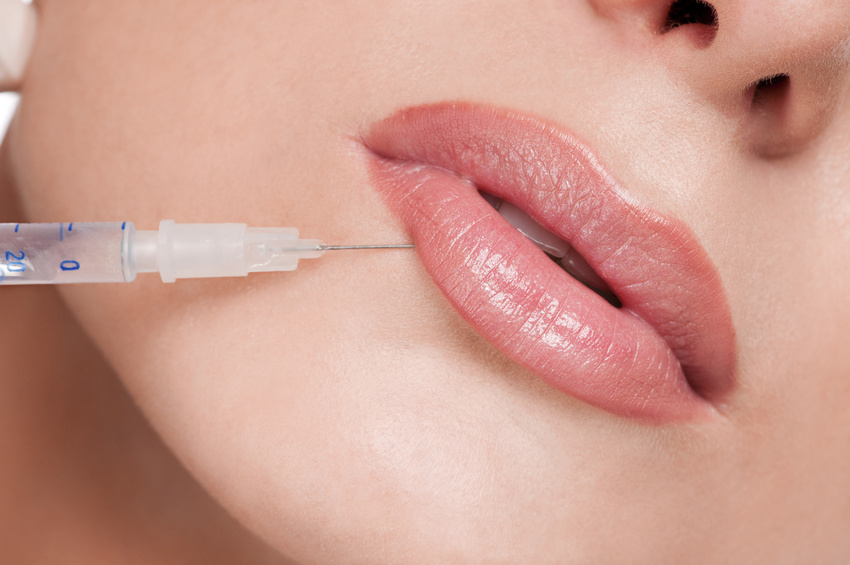 Cosmetic botox injection in the female face. Lips zone. Isolated | Foto: mr.markin/ Fotolia
